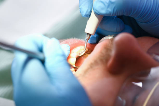 Best Urgent Care for Lost Fillings or Crowns in Haleiwa, HI