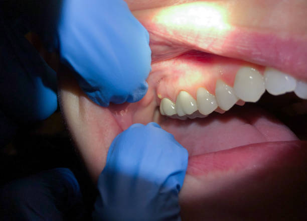 Best Emergency Gum Treatment in Haleiwa, HI